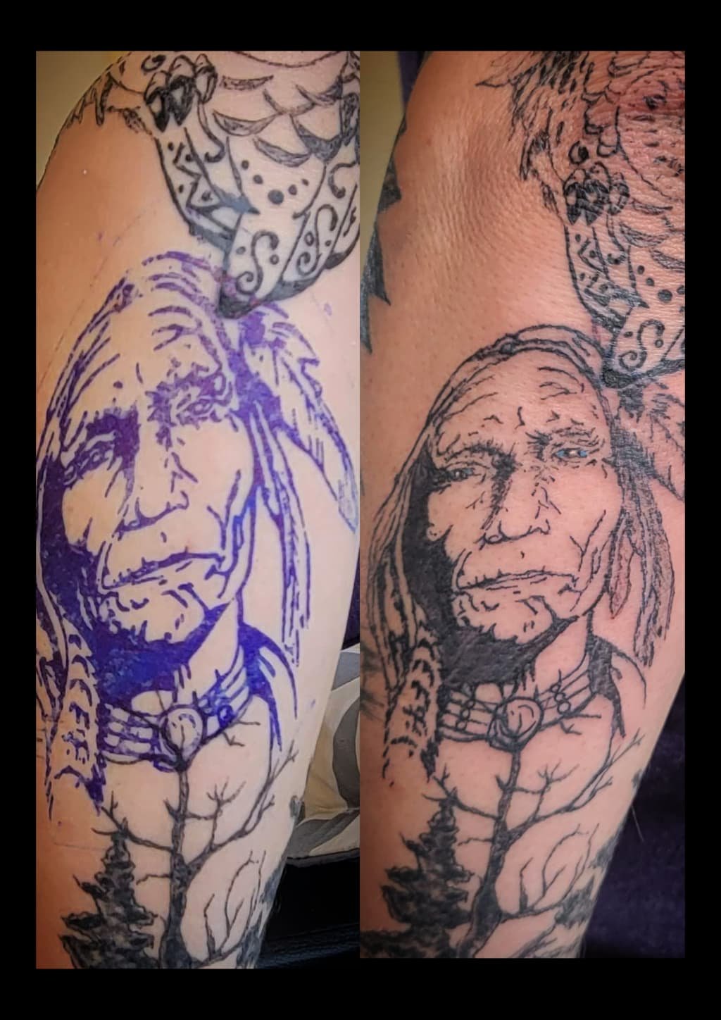 before_after